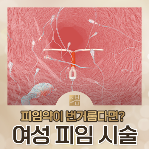 미레나·카일리나·임플라논, 나에게 맞는 피임 시술은 어떻게 고르나요?