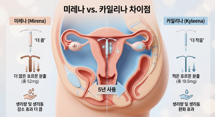 미레나·카일리나·임플라논, 피임 시술 어떻게 다른가요? 관련 해부 구조 그림
